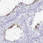 Immunohistochemical staining of human testis shows high expression.