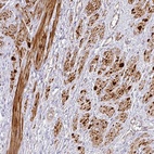 Anti-TARM1 Antibody