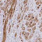Anti-TARM1 Antibody