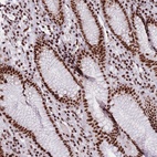 Anti-TMEM35B Antibody