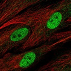 Anti-C1orf204 Antibody