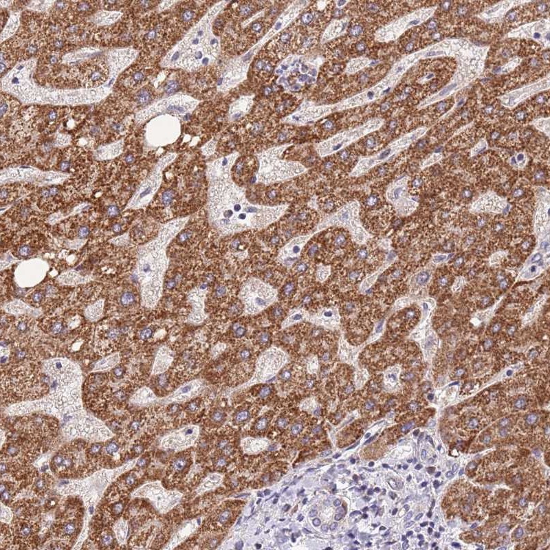 Anti-TOPAZ1 Antibody