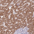 Anti-TOPAZ1 Antibody