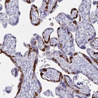 Anti-PEG10 Antibody