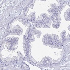 Immunohistochemical staining of human prostate shows low expression as expected.