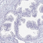 Immunohistochemical staining of human prostate shows low expression as expected.