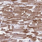 Immunohistochemical staining of human heart muscle shows strong cytoplasmic positivity in cardiomyocytes.