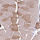 Immunohistochemical staining of human skeletal muscle shows moderate cytoplasmic positivity in myocytes.