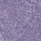 Immunohistochemical staining of human lymphoid tissues shows no positivity in non-germinal center cells as expected.