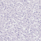 Immunohistochemical staining of human liver shows no positivity in hepatocytes as expected.