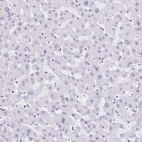 Immunohistochemical staining of human liver shows no positivity in hepatocytes as expected.
