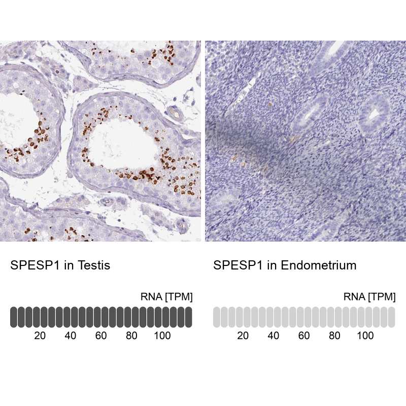 Anti-SPESP1 Antibody