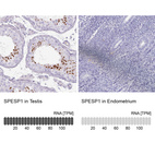 Anti-SPESP1 Antibody