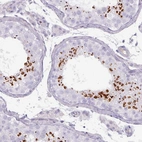 Immunohistochemical staining of human testis shows high expression.