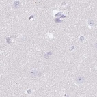 Immunohistochemical staining of human cerebral cortex using Anti-SPESP1 antibody HPA051040.