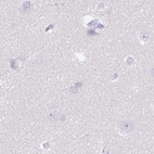 Immunohistochemical staining of human cerebral cortex using Anti-SPESP1 antibody HPA051040.