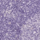 Immunohistochemical staining of human lymph node using Anti-SPESP1 antibody HPA051040.