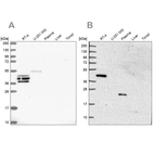 Western blot analysis using Anti-SPESP1 antibody HPA051040 (A) shows similar pattern to independent antibody HPA045936 (B).