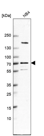 Western blot analysis in human cell line NB4.