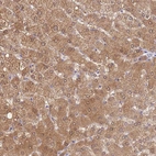 Immunohistochemical staining of human liver shows weak cytoplasmic positivity in hepatocytes.