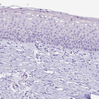 Immunohistochemical staining of human cervix, uterine shows no positivity in squamous epithelial cells as expected.