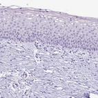 Immunohistochemical staining of human cervix, uterine shows no positivity in squamous epithelial cells as expected.