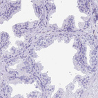 Immunohistochemical staining of human prostate shows no positivity in glandular cells as expected.