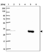 Lane 1: Marker [kDa] 250, 130, 95, 72, 55, 36, 28, 17, 10_br/_Lane 2: Human cell line RT-4_br/_Lane 3: Human cell line U-251MG sp_br/_Lane 4: Human plasma (IgG/HSA depleted)_br/_Lane 5: Human liver tissue_br/_Lane 6: Human tonsil tissue