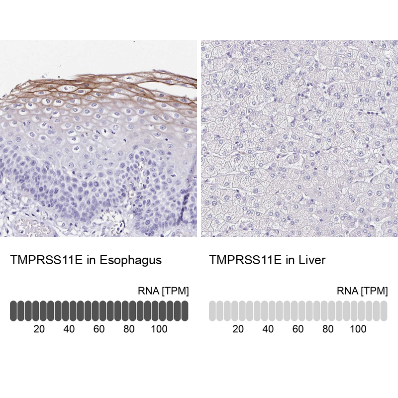 Anti-TMPRSS11E Antibody