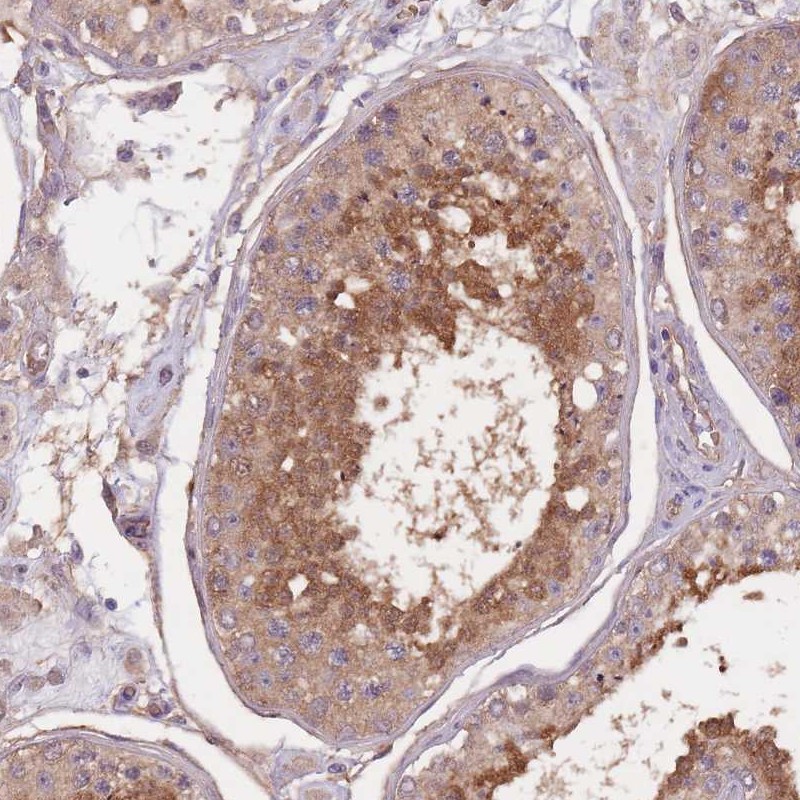 Anti-KIAA1755 Antibody