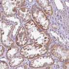 Immunohistochemical staining of human kidney shows strong cytoplasmic granular positivity in cells in tubules.