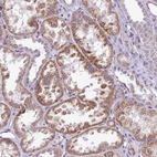 Immunohistochemical staining of human kidney shows strong cytoplasmic granular positivity in cells in tubules.