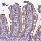 Immunohistochemical staining of human duodenum shows moderate cytoplasmic granular positivity in glandular cells.