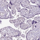 Immunohistochemical staining of human placenta shows no positivity in trophoblastic cells as expected.