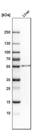 Western blot analysis in human liver tissue.