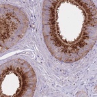 Anti-KIAA1211L Antibody