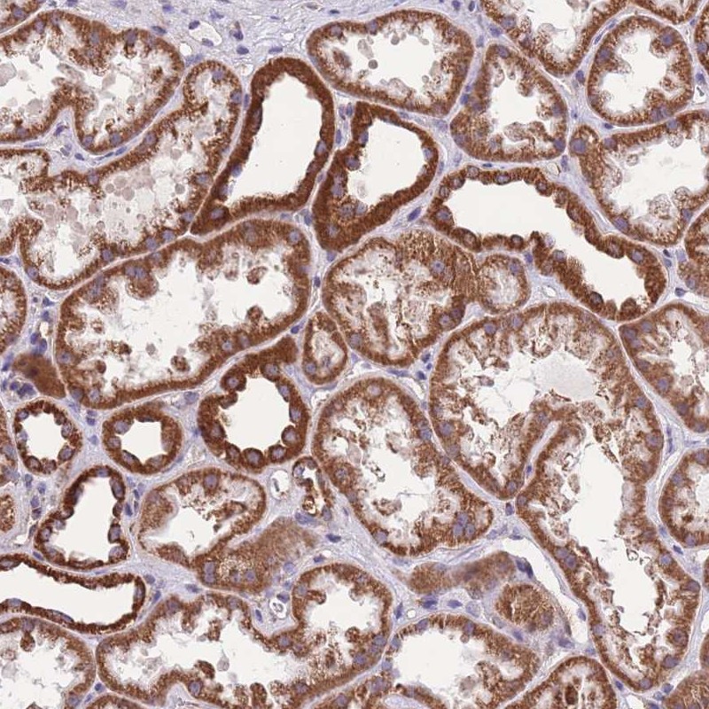 Anti-KCNH3 Antibody