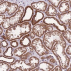 Anti-KCNH3 Antibody