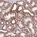 Anti-KCNH3 Antibody