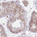 Immunohistochemical staining of human testis shows strong cytoplasmic granular positivity in cells in seminiferous ducts.