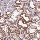 Immunohistochemical staining of human kidney shows strong cytoplasmic granular positivity in cells in tubules.