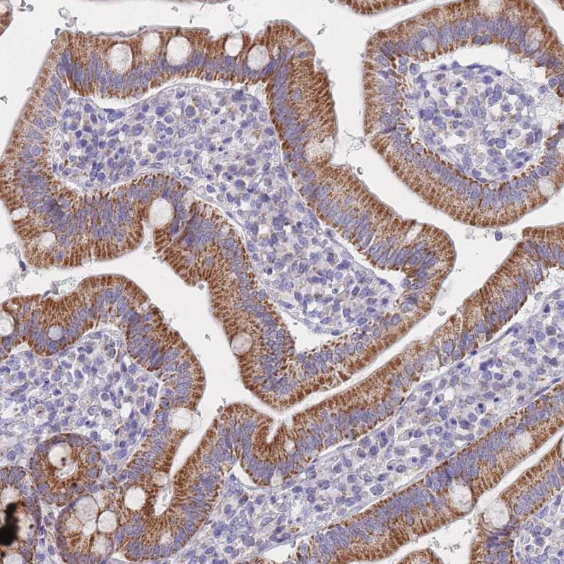 Anti-MRPS14 Antibody