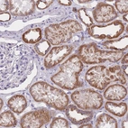Immunohistochemical staining of human Kidney shows strong granular cytoplasmic positivity in cells in tubules.