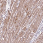 Immunohistochemical staining of human Heart muscle shows moderate cytoplasmic positivity in cardiomyocytes.