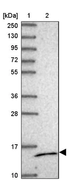 Lane 1: Marker [kDa] 250, 130, 95, 72, 55, 36, 28, 17, 10_br/_Lane 2: Human cell line RT-4