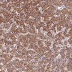Anti-ST3GAL3 Antibody