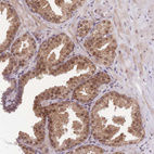 Anti-MINDY2 Antibody