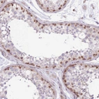 Immunohistochemical staining of human testis shows moderate nuclear positivity in cells in seminiferous ducts.