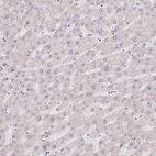 Immunohistochemical staining of human liver shows no positivity in hepatocytes as expected.