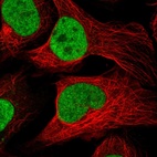 Immunofluorescent staining of human cell line U-2 OS shows localization to nucleoplasm.